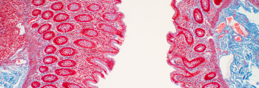 Image of tissue of the large intestine. (Cleveland Clinic)